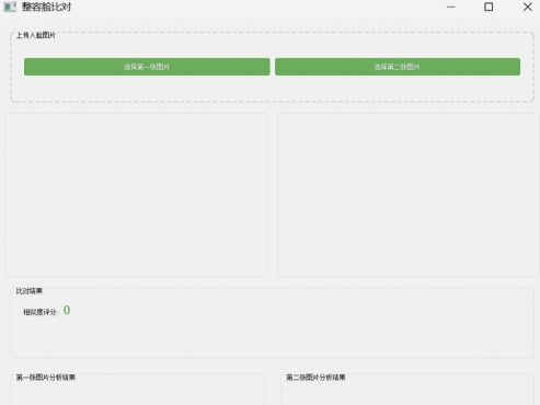 整容脸比对系统